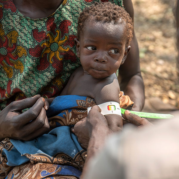 Child in South Sudan having arm measurement taken to check for malnutrition
