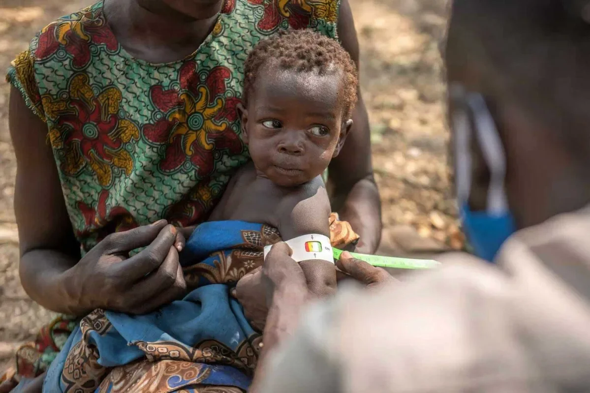 A young baby being treated by a doctor in a village in Africa.